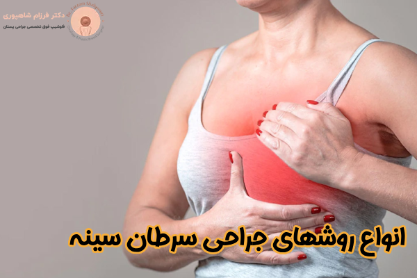 انواع روشهای جراحی سرطان سینه