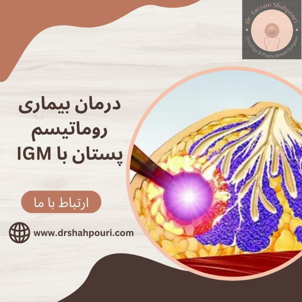 درمان ماستیت گرانولوماتوز با IGM