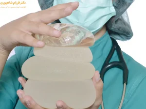 جابه جایی پروتز سینه