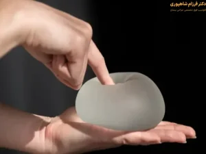 حس سینه بعد از پروتز