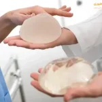 سایز پروتز سینه