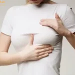 محل قرار گیری پروتز سینه