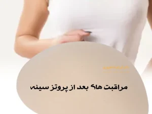 مراقبت های بعد از پروتز سینه