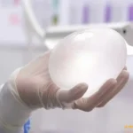 پروتز سینه مدل گرد