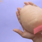 پروتز سینه و سرطان