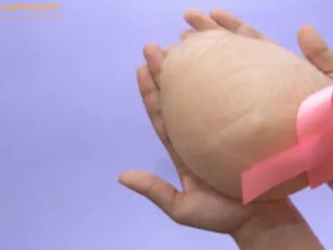 پروتز سینه و سرطان