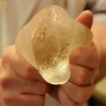 عفونت بعد از پروتز سینه