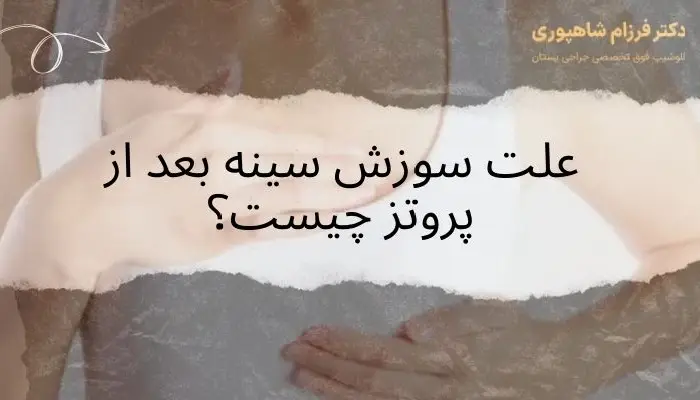 سوزش سینه بعد از پروتز