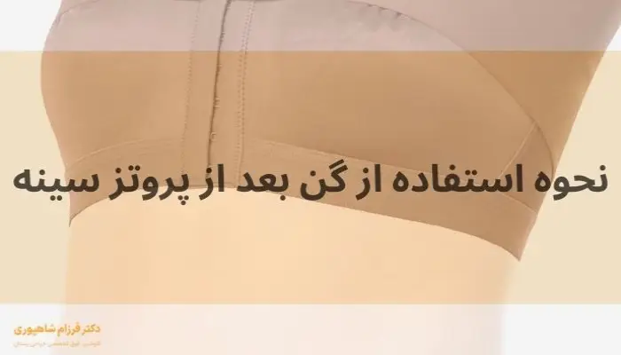 نحوه استفاده از گن بعد از پروتز سینه