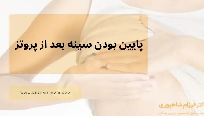پایین بودن سینه بعد از پروتز
