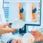 بهترین سن عمل پروتز سینه