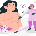 تزریق چربی به سینه بهتر است یا پروتز 