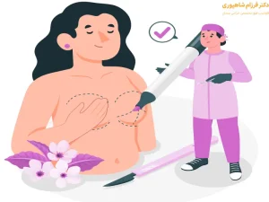 تزریق چربی به سینه بهتر است یا پروتز 