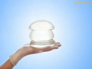 ورزش بعد از پروتز سینه