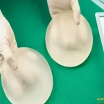 پروتز سينه و پرواز با هواپيما
