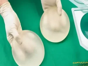 پروتز سينه و پرواز با هواپيما