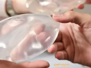 پروتز سینه و شیردهی
