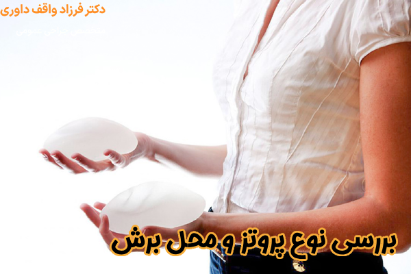 بررسی نوع پروتز