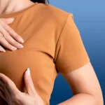 اقدامات قبل از پروتز سینه