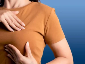 اقدامات قبل از پروتز سینه