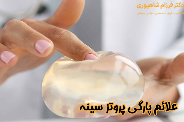 علائم پارگی پروتز سینه