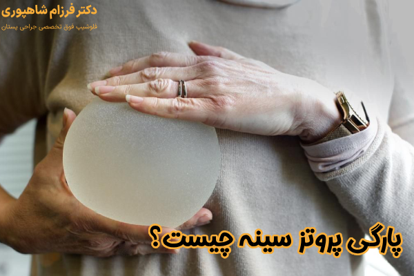 پارگی پروتز سینه چیست