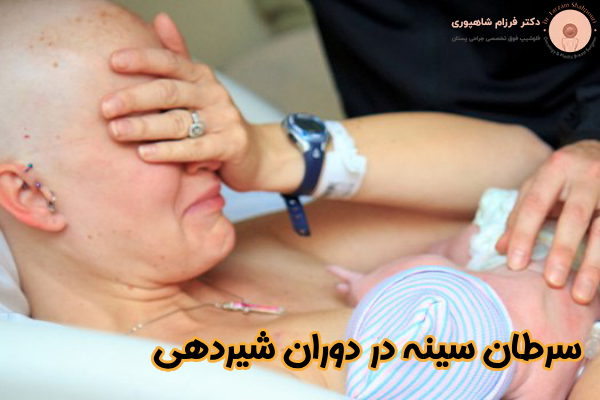 سرطان سینه در دوران شیردهی