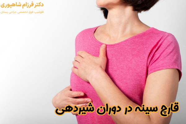 قارچ سینه در دوران شیردهی