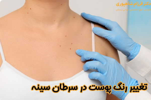 تغییر رنگ پوست در سرطان سینه