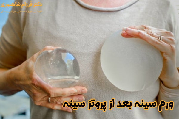 ورم بعد از پروتز سینه