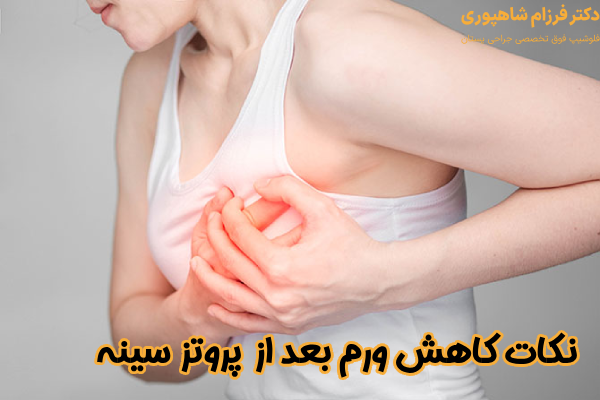 نکات کاهش ورم بعد از پروتز سینه
