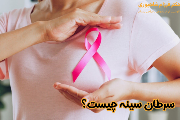 سرطان سینه چیست