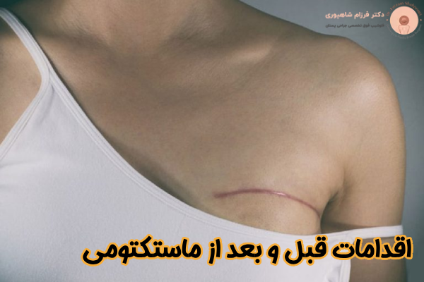 اقدامات قبل و بعد از ماستکتومی