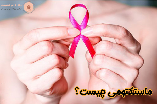 ماستکتومی چیست