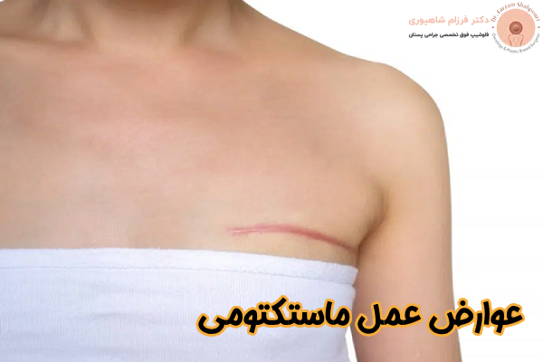 عوارض جراحی ماستکتومی