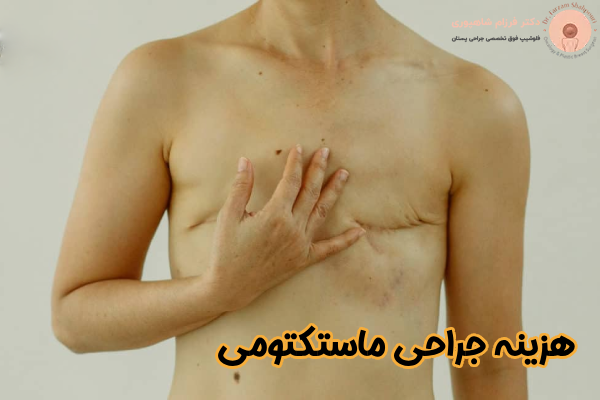 هزینه جراحی ماستکتومی