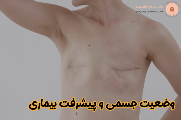 وضعیت جسمی و پیشرفت بیماری