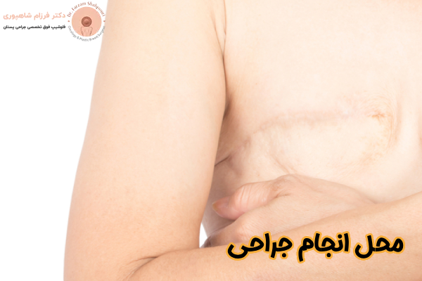 محل انجام جراحی