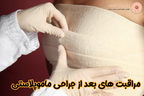 اقدامات بعد از ماموپلاستی