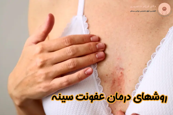 روشهای درمان عفونت سینه