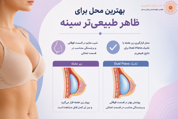 محل برای ظاهر طبیعی سینه