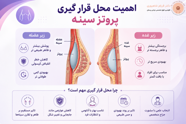 اهمیت محل قرارگیری پروتز سینه