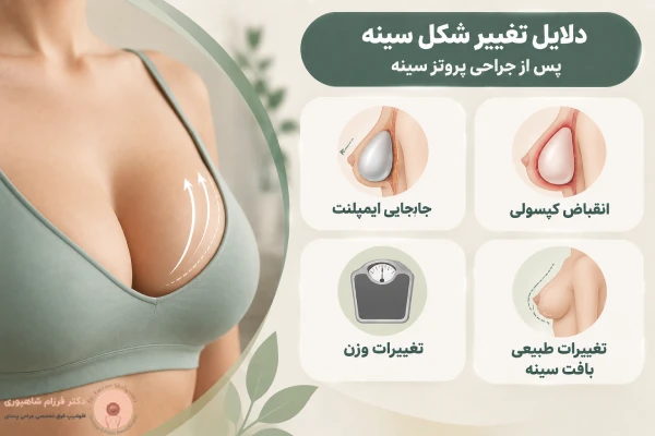 تغییر شکل سینه